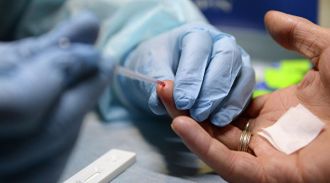 Более 20 тысяч россиян умерли в 2018 году от ВИЧ-инфекции